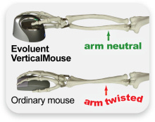evoluent vertical mouse sceleton arm